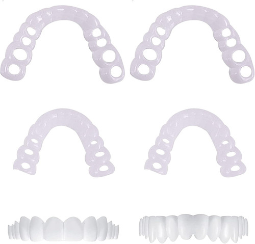 Temporäre veneers zahnersatz - veneers,