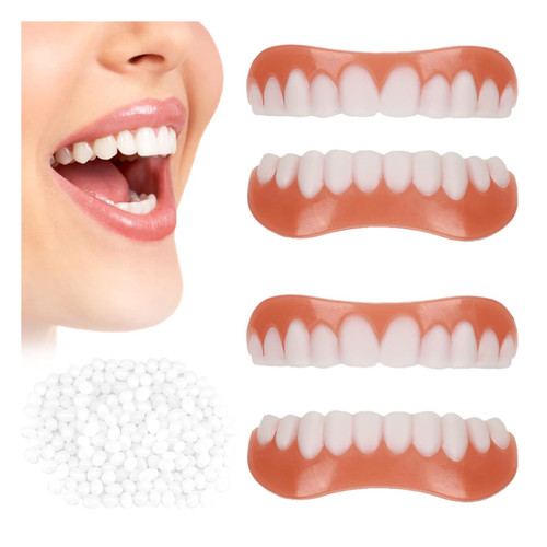 Kosmetische zähne veneers - veneers, 2