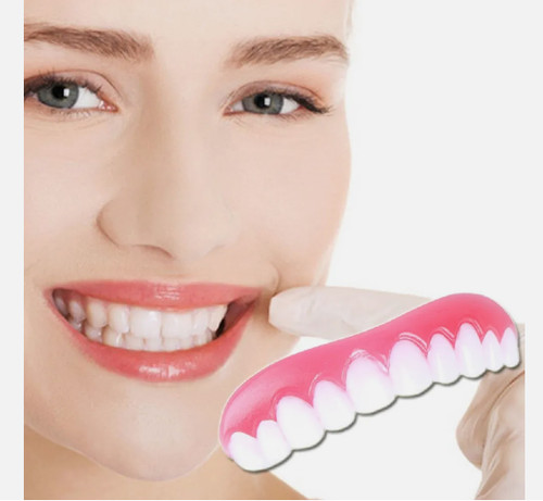 Smile snap veneers zähne - veneers,