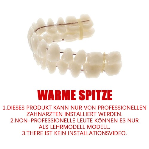 Snap veneers kosmetische - on, -veneers-