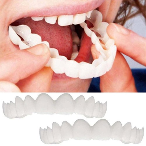Zahnersatz veneers set paare - veneers, 2