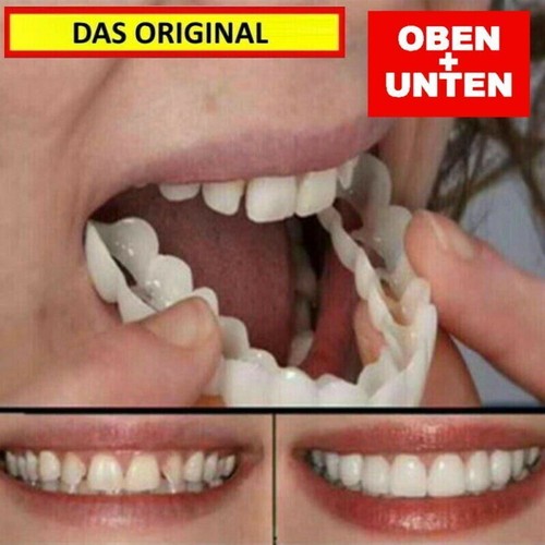 Snap veneers kosmetische - snap, on