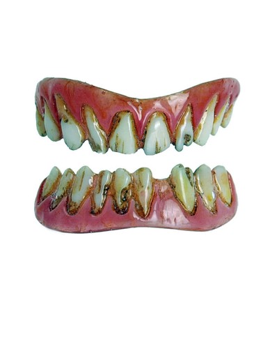 Dental veneers - dental,