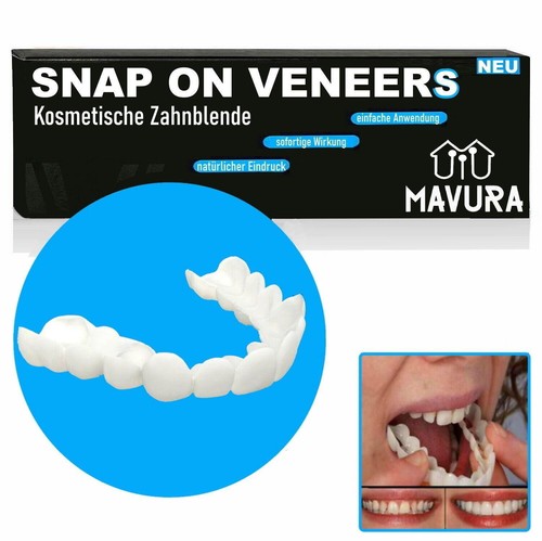 Snap veneers kosmetische - snap,