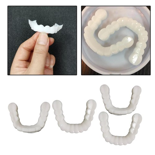 Veneers simulation zahnspangen - veneers,