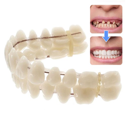 Snap veneers kosmetische - on,