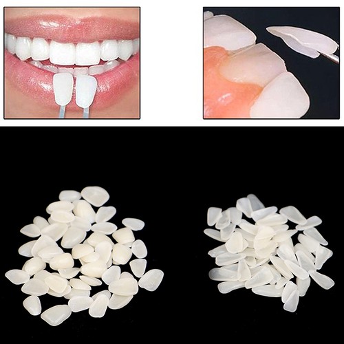 60pcs dental ultra thin - dental, ultra-thin
