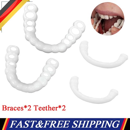 Neu snap veneers - on,