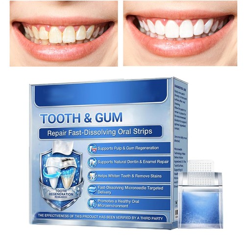 Glimmerly tooth gum - &, repair