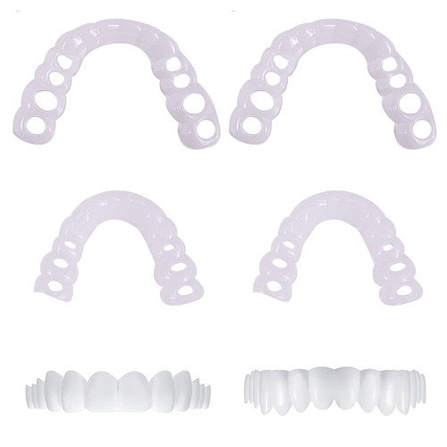 Zahnersatz veneers set paare - veneers, 2