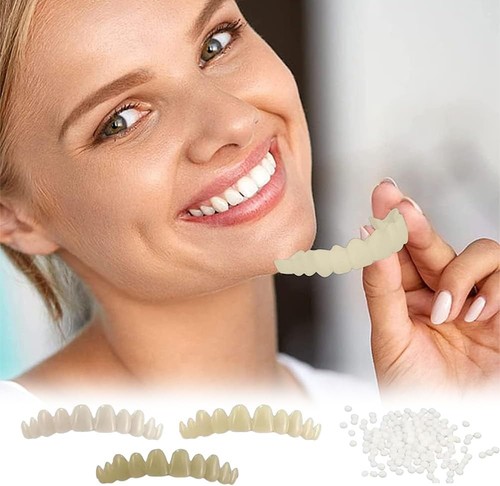 Prothesen veneers paar - veneers,