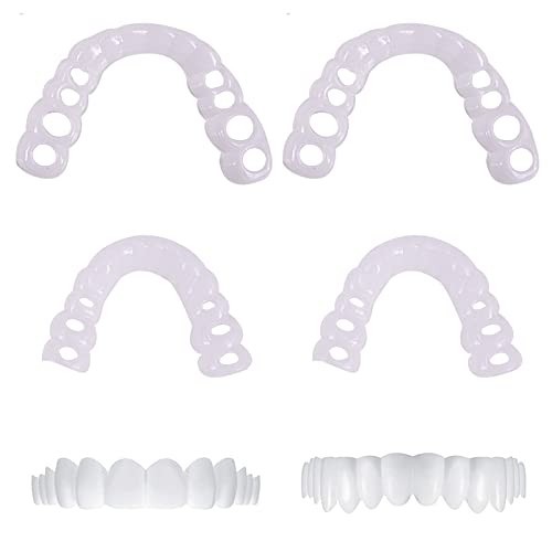Zahnersatz veneers set - veneers, 2